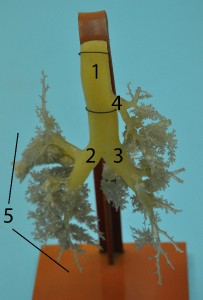 pruduskovy-strom.jpg